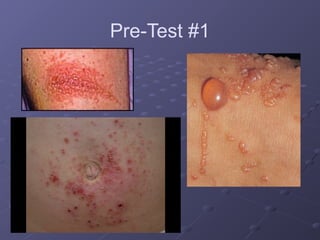 dermatology for understanding core medical concept.pptx