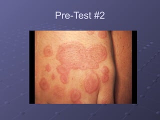dermatology for understanding core medical concept.pptx
