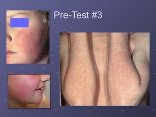 dermatology for understanding core medical concept.pptx