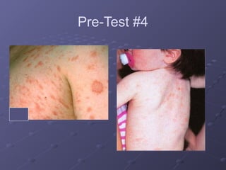 dermatology for understanding core medical concept.pptx