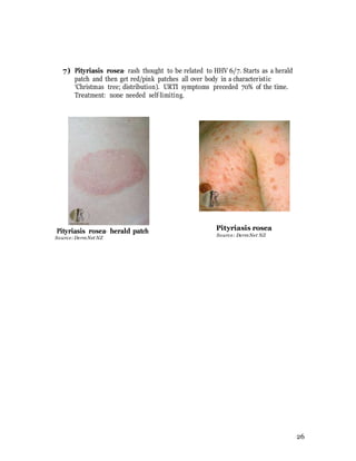 Ovoid Rash Dermatology revision book | DOCX