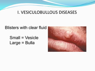 Vesication Comprehensive Dermatology: Diagnosis and Management of Skin Lesions and ...