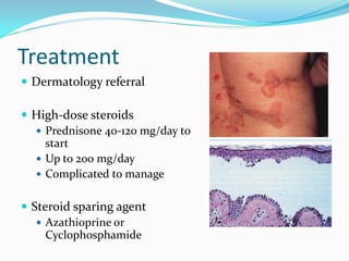 Skin Rashes From Prednisone Comprehensive Dermatology: Diagnosis and Management of Skin Lesions and ...
