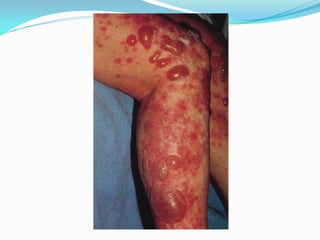 Plect Comprehensive Dermatology: Diagnosis and Management of Skin Lesions and ...