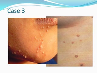 Comprehensive Dermatology: Diagnosis and Management of Skin Lesions and ...
