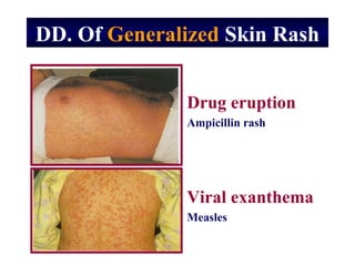 Dermatology approach | PPT