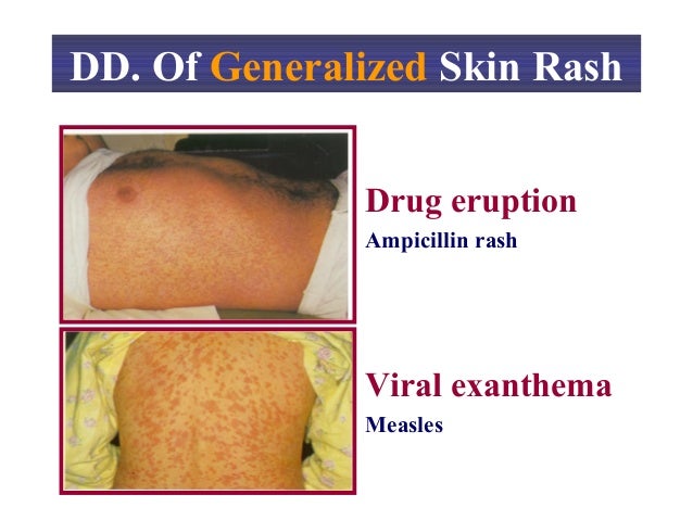 Dermatology Approach