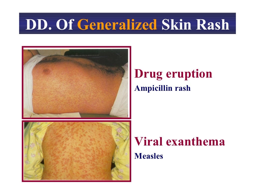 Dermatology approach
