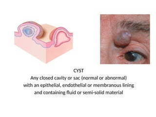Comprehensive Overview of Dermatological Lesions and Diseases | PPTX
