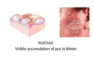 Comprehensive Overview of Dermatological Lesions and Diseases | PPTX