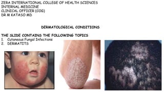 ZERA INTERNATIONAL COLLEGE OF HEALTH SCIENCES
INTERNAL MEDICINE
CLINICAL OFFICER (COG)
DR M KATASO MD
DERMATOLOGICAL CONDITIONS
THE SLIDE CONTAINS THE FOLLOWING TOPICS
1. Cutaneous Fungal Infections
2. DERMATITS
 