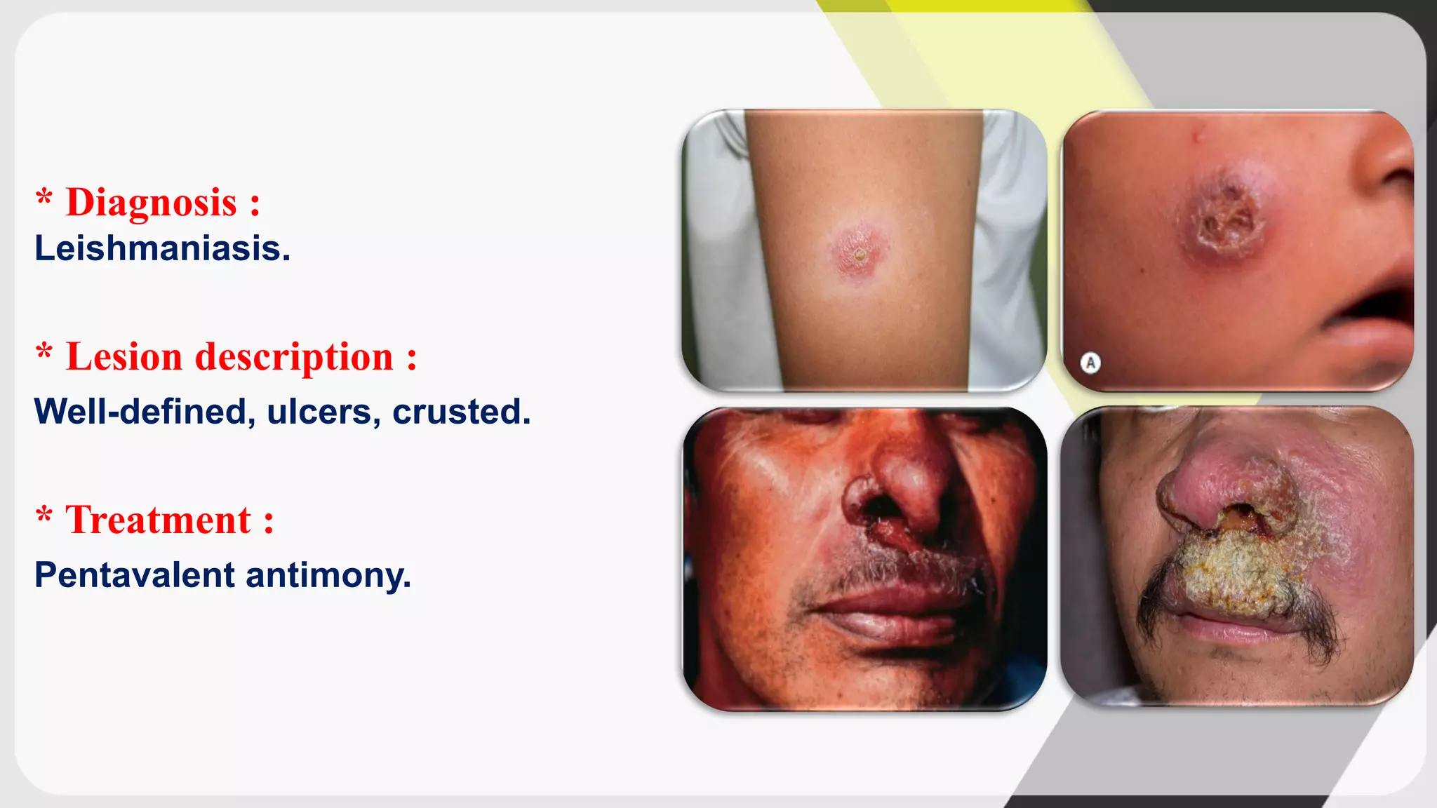 Dermatology diagnosis Of Dermatological Lesions PDF dermatology-diagnosis-of-dermatological-lesions-pdf
