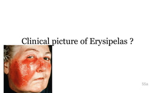 Clinical picture of Erysipelas ?
55a
 