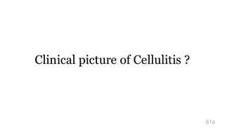 Clinical picture of Cellulitis ?
61a
 