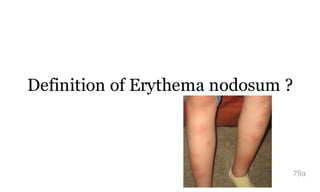 Definition of Erythema nodosum ?
79a
 