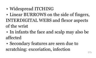 ⋆ Widespread ITCHING
⋆ Linear BURROWS on the side of fingers,
INTERDIGITAL WEBS and flexor aspects
of the wrist
⋆ In infants the face and scalp may also be
affected
⋆ Secondary features are seen due to
scratching: excoriation, infection
97b
 
