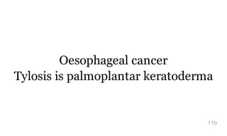 Oesophageal cancer
Tylosis is palmoplantar keratoderma
11b
 