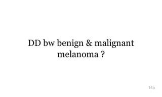 DD bw benign & malignant
melanoma ?
14a
 