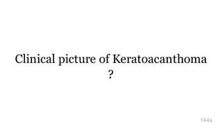 Clinical picture of Keratoacanthoma
?
144a
 