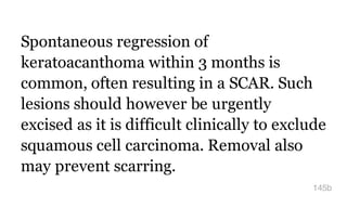 Spontaneous regression of
keratoacanthoma within 3 months is
common, often resulting in a SCAR. Such
lesions should however be urgently
excised as it is difficult clinically to exclude
squamous cell carcinoma. Removal also
may prevent scarring.
145b
 
