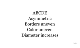 ABCDE
Asymmetric
Borders uneven
Color uneven
Diameter increases
14b
 