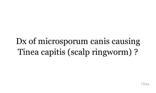 Dx of microsporum canis causing
Tinea capitis (scalp ringworm) ?
154a
 