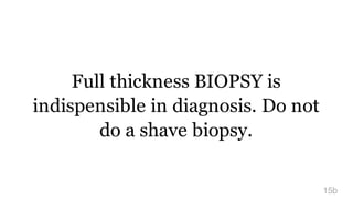 Full thickness BIOPSY is
indispensible in diagnosis. Do not
do a shave biopsy.
15b
 
