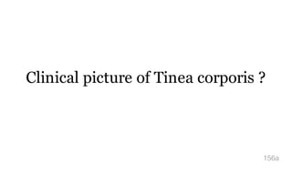 Clinical picture of Tinea corporis ?
156a
 
