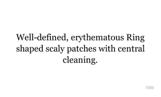 Well-defined, erythematous Ring
shaped scaly patches with central
cleaning.
156b
 