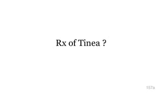 Rx of Tinea ?
157a
 