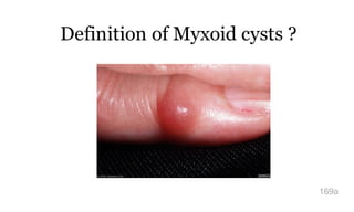 Definition of Myxoid cysts ?
169a
 