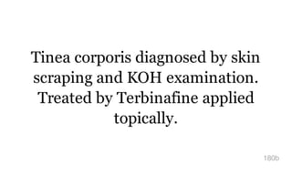 Tinea corporis diagnosed by skin
scraping and KOH examination.
Treated by Terbinafine applied
topically.
180b
 