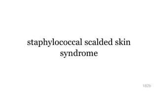 staphylococcal scalded skin
syndrome
182b
 