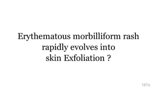Erythematous morbilliform rash
rapidly evolves into
skin Exfoliation ?
187a
 