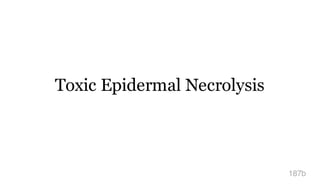 Toxic Epidermal Necrolysis
187b
 