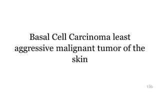 Basal Cell Carcinoma least
aggressive malignant tumor of the
skin
19b
 