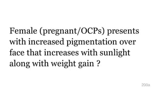 Female (pregnant/OCPs) presents
with increased pigmentation over
face that increases with sunlight
along with weight gain ?
200a
 
