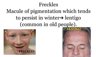 Freckles
Macule of pigmentation which tends
to persist in winter➜ lentigo
(common in old people).
201bFRECKLES
LENTIGO
 