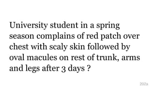 University student in a spring
season complains of red patch over
chest with scaly skin followed by
oval macules on rest of trunk, arms
and legs after 3 days ?
202a
 