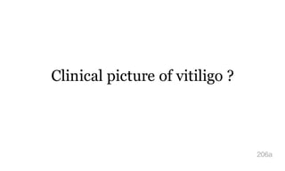 Clinical picture of vitiligo ?
206a
 
