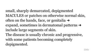 small, sharply demarcated, depigmented
MACULES or patches on otherwise normal skin,
often on the hands, face, or genitalia ➜
expand, sometimes in dermatomal patterns ➜
include large segments of skin.
The disease is usually chronic and progressive,
with some patients becoming completely
depigmented.
206b
 