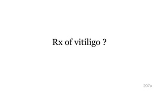 Rx of vitiligo ?
207a
 