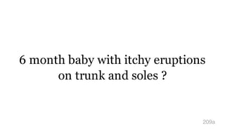 6 month baby with itchy eruptions
on trunk and soles ?
209a
 