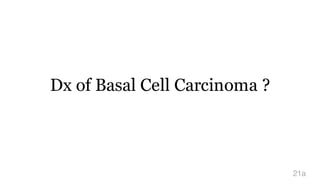Dx of Basal Cell Carcinoma ?
21a
 