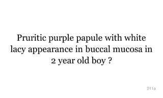 Pruritic purple papule with white
lacy appearance in buccal mucosa in
2 year old boy ?
211a
 