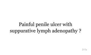 Painful penile ulcer with
suppurative lymph adenopathy ?
217a
 