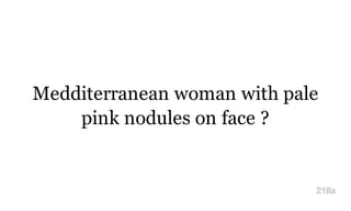 Medditerranean woman with pale
pink nodules on face ?
218a
 