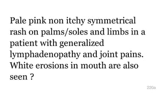 Pale pink non itchy symmetrical
rash on palms/soles and limbs in a
patient with generalized
lymphadenopathy and joint pains.
White erosions in mouth are also
seen ?
220a
 