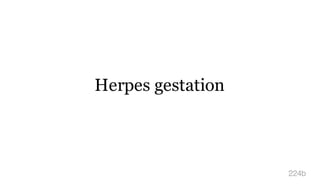 Herpes gestation
224b
 