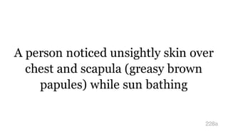 A person noticed unsightly skin over
chest and scapula (greasy brown
papules) while sun bathing
228a
 
